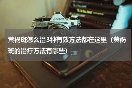 黄褐斑怎么治3种有效方法都在这里（黄褐斑的治疗方法有哪些）