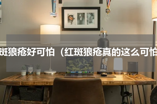 红斑狼疮好可怕（红斑狼疮真的这么可怕）