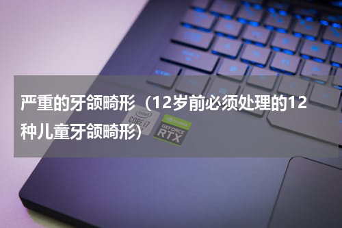 严重的牙颌畸形（12岁前必须处理的12种儿童牙颌畸形）