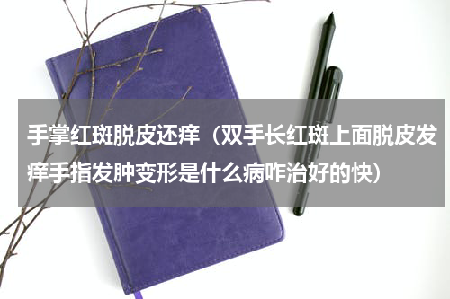 手掌红斑脱皮还痒（双手长红斑上面脱皮发痒手指发肿变形是什么病咋治好的快）
