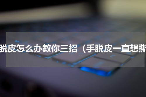手脱皮怎么办教你三招（手脱皮一直想撕）