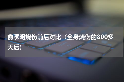 俞灏明烧伤前后对比（全身烧伤的800多天后）