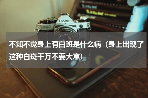 不知不觉身上有白斑是什么病（身上出现了这种白斑千万不要大意）