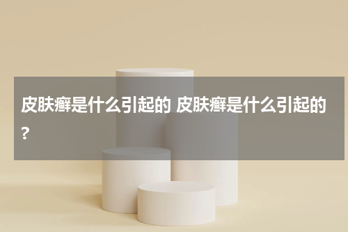皮肤癣是什么引起的 皮肤癣是什么引起的?