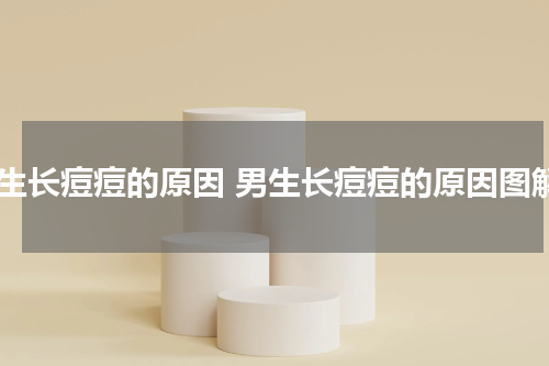 男生长痘痘的原因 男生长痘痘的原因图解